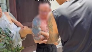 WN Australia Piting Kaki Warga di Denpasar Ditahan Imigrasi Gegara Overstay