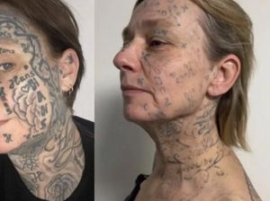 Kejam! Wanita Ini Dipaksa Tato 250 Nama Pacar di Tubuh & Wajah