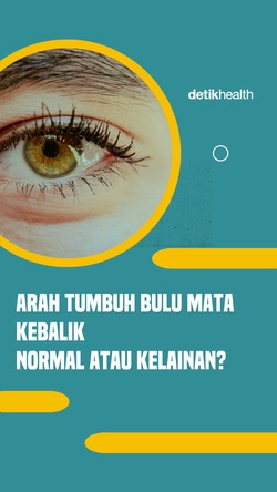 Video: Arah Tumbuh Bulu Mata Kebalik, Normal atau Kelainan?