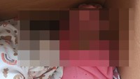 Ditemukan Lebam pada Tubuh Bayi Dibuang di Bawah Pohon Malang