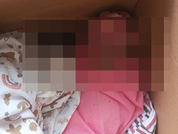 Ditemukan Lebam pada Tubuh Bayi Dibuang di Bawah Pohon Malang