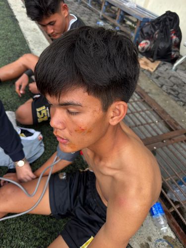 Aksi tidak sportif terjadi di laga Elite Pro Academi (EPA) U-20 saat Bhayangkara FC jumpa Dewa United U-20 di Stadion Citarum, Semarang, Minggu (19/4/2026). Pemain Bhayangkara melakukan tendangan kungfu ke arah perut pemain Dewa United setelah laga.