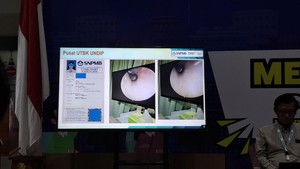 Kecurangan UTBK 2026 Hari Pertama: Modifikasi Foto-Telinga Ditanami Alat Dengar