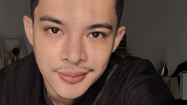 Rey Mbayang Idap Autoimun Psoriasis