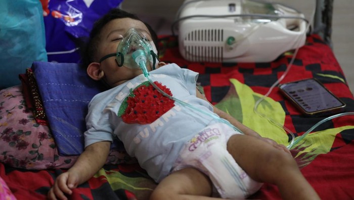 Wabah Campak Children receive treatment at a hospital in Dhaka, Bangladesh, in April 2026, amid a growing measles outbreak. The number of infections and deaths continues to rise across the country, placing increasing pressure on healthcare facilities. (Photo by Sony Ramani/NurPhoto via Getty Images)