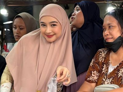 Ria Ricis Luruskan soal Operasi Hidung dan Wajah Berubah