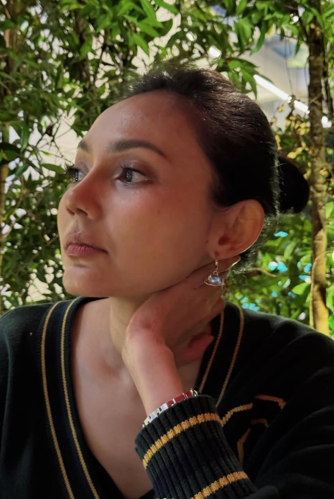 Alih-alih oplas ke luar negeri, Rina Nose mempercayakan tindakan rhinoplastynya di Jakarta bersama dokter Tompi. Setelah oplas, Rina tampak makin percaya diri memamerkan hidung barunya tersebut. Foto: Instagram