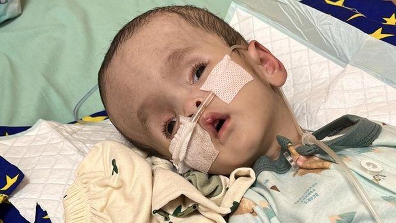 Kisah Anugerah, Bayi 6 Bulan Penderita Hidrosefalus yang Berjuang Sembuh