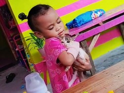 Arumi Korban Malapraktik Berujung Amputasi di Bima Sering Tanya Mana Tangan?