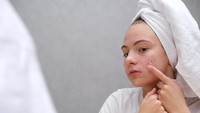 Jangan Salah Pilih, Ini Skincare untuk Kulit Sensitif, Berminyak & Berjerawat