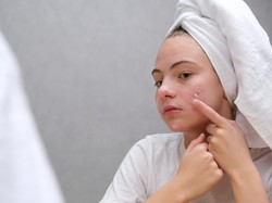 Tretinoin: Manfaat, Cara Pakai, dan Efek Samping untuk Jerawat & Anti-Aging