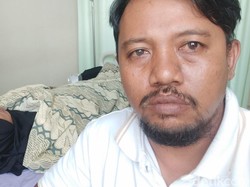 Kena Semburan Kobra, Mata Warga Pamekasan Kembali Normal gegara Hal Ini