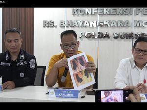 2 Korban Selamat Kecelakaan Bus ALS Jalani Operasi di RS Bhayangkara Palembang