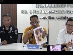2 Korban Selamat Kecelakaan Bus ALS Jalani Operasi di RS Bhayangkara Palembang