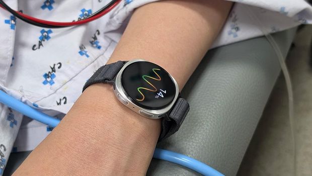 Galaxy Watch Bisa Prediksi Pingsan