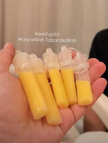 Alyssa Daguise Simpan Kolostrum di Spuit Kecil, Memang Sepenting Itu?
