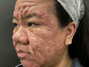 Viral Transformasi Wajah Wanita Sebelum dan Sesudah Hamil, Bikin Kena Mental