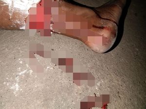Anjing Diduga Rabies Gigit Lima Warga Desa di Kupang