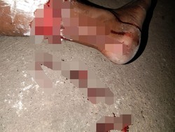 Anjing Diduga Rabies Gigit Lima Warga Desa di Kupang