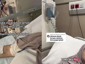 Viral Wanita Bekasi Kena Gagal GInjal di Usia Muda, Gejalanya Terlihat di Wajah