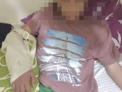 Remaja Patah Tangan Diduga Dikeroyok OTK di Pontianak, Keluarga Lapor Polisi