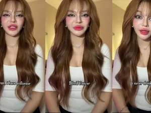 Pengakuan Influencer yang Kena Kanker Darah Usai Minum Boba 5 Gelas Sehari