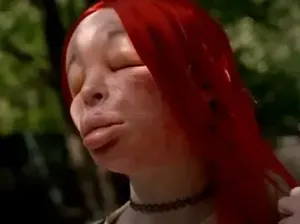 Nekat Suntik Silikon Sendiri, Wajah Wanita Ini Berubah Hingga Sulit Dikenali