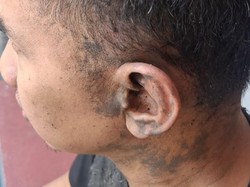 Tegur Tetangga Buang Sampah Sembarangan, Guru Les Pontianak Dianiaya ke Parit