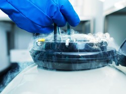 Banyak Selebriti Jalani Egg Freezing, Berapa Usia Ideal Wanita Bekukan Sel Telur?