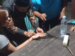 Paniknya Remaja Banyuwangi Datangi Damkar gegara Jarinya Bengkak