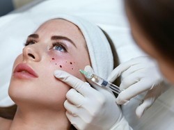 Mau Awet Muda? Ini Dos & Donts Setelah Skin Booster yang Wajib Kamu Tahu