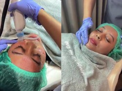 Video: Semua yang Perlu Kamu Tahu soal Skin Booster Alias Tren Bentol Sultan