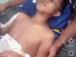 Sadis, 3 Santri di Lombok Dibakar Teman-1 Meninggal Dunia