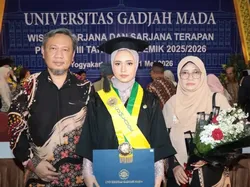 Usia 20 Tahun Sudah Lulus S1 Kedokteran UGM, Fulviana Punya Rahasia Ini
