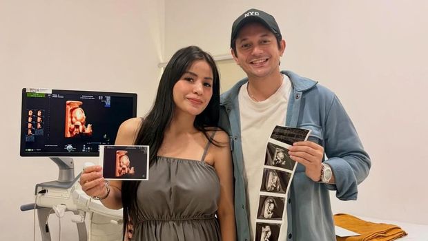 Andrew Andika umumkan istri hamil.