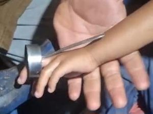 Jari Balita di Wonosari Nyangkut Tutup Botol, Ortu Panggil Damkar