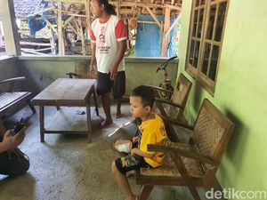 Lepas dari Penangkaran, Beruk Serang 3 Orang di Gunungkidul
