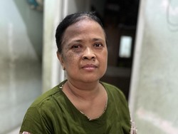 Gigitan Serangga Jadi Nanah dan Bikin Sadiyah Tak Bisa Bekerja, Yuk Kita Bantu!