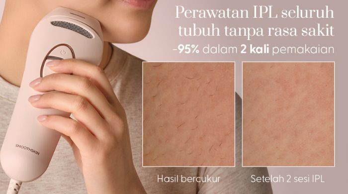 Perawatan IPL Seluruh tubuh Tanpa Rasa Sakit
