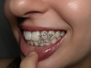 Ini Tooth Gem, Aksesori Gigi yang Lagi Tren di Kalangan Gen Z