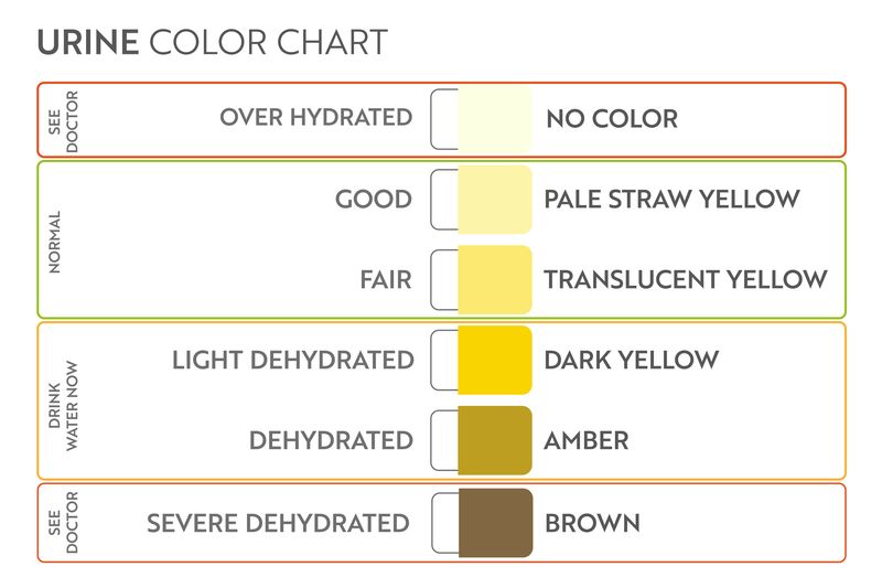 Urine color chart.