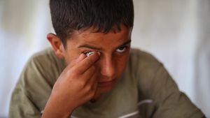 Bocah Palestina Menanti Mata Prostetik di Tengah Pengungsian Gaza