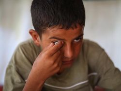 Bocah Palestina Menanti Mata Prostetik di Tengah Pengungsian Gaza