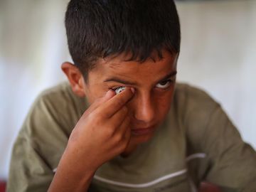 Bocah Palestina Menanti Mata Prostetik di Tengah Pengungsian Gaza