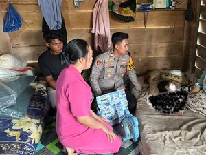 Sambut HUT Bhayangkara, Polisi Beri Bantuan ke Anak Penderita Hidrosefalus