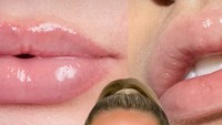 Tren Gym Lips, Rahasia Bibir Plumpy dengan Effort Minimal