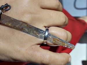 25 Menit Menegangkan Saat Damkar Sukabumi Potong Cincin Menjepit Jari