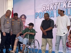 Bahagia Aspiyani Dapat Kaki Baru Usai Setahun Menanti, Ingin Cari Kerja Lagi
