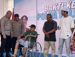 Bahagia Aspiyani Dapat Kaki Baru Usai Setahun Menanti, Ingin Cari Kerja Lagi