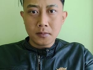 RSHS Ungkap Sejumlah Belatung Ditemukan di Kepala Wanita Korban Taufik Hidayat
